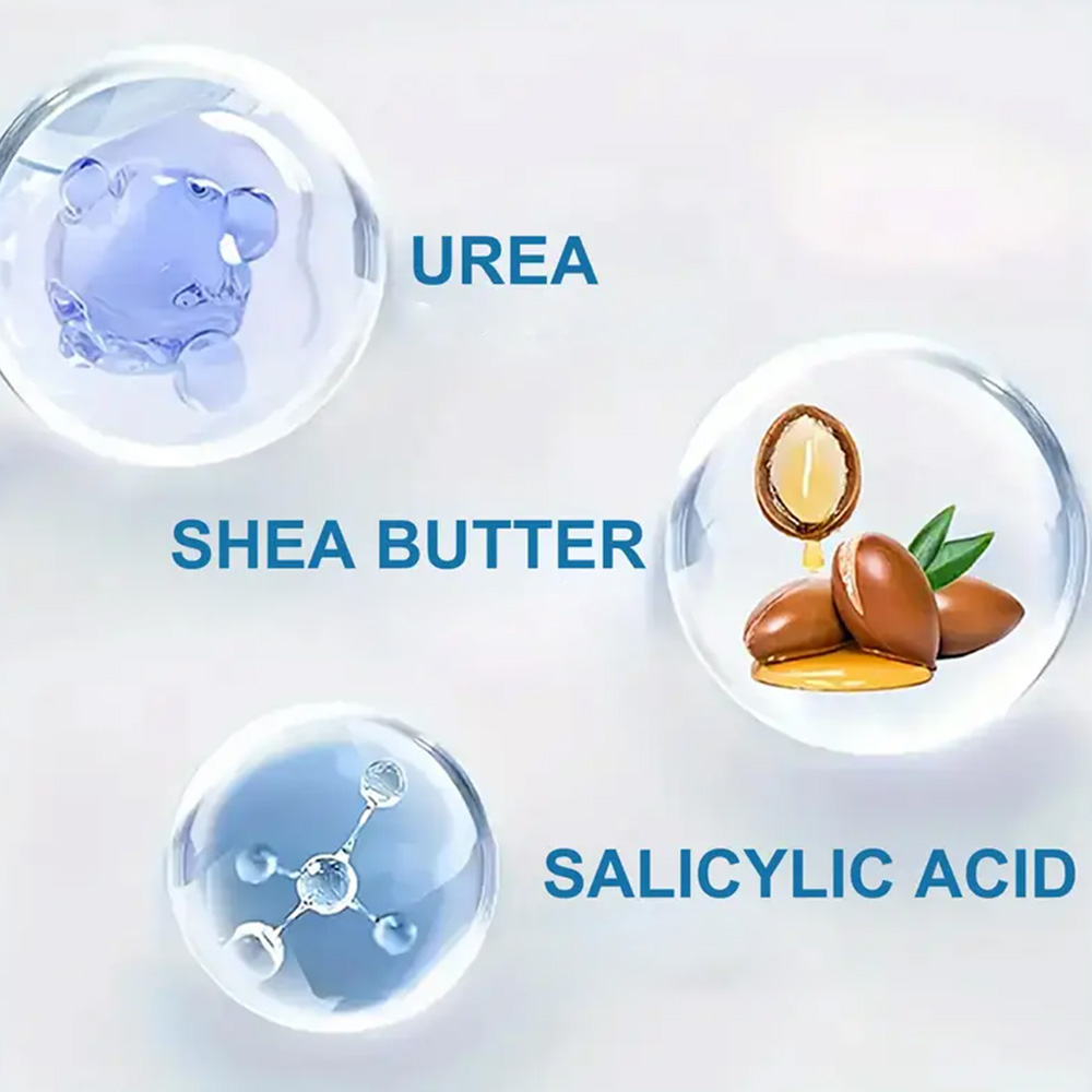 YOUNGCOME 250G Urea Cream with - Azelaic Acid Cream reseña y precio