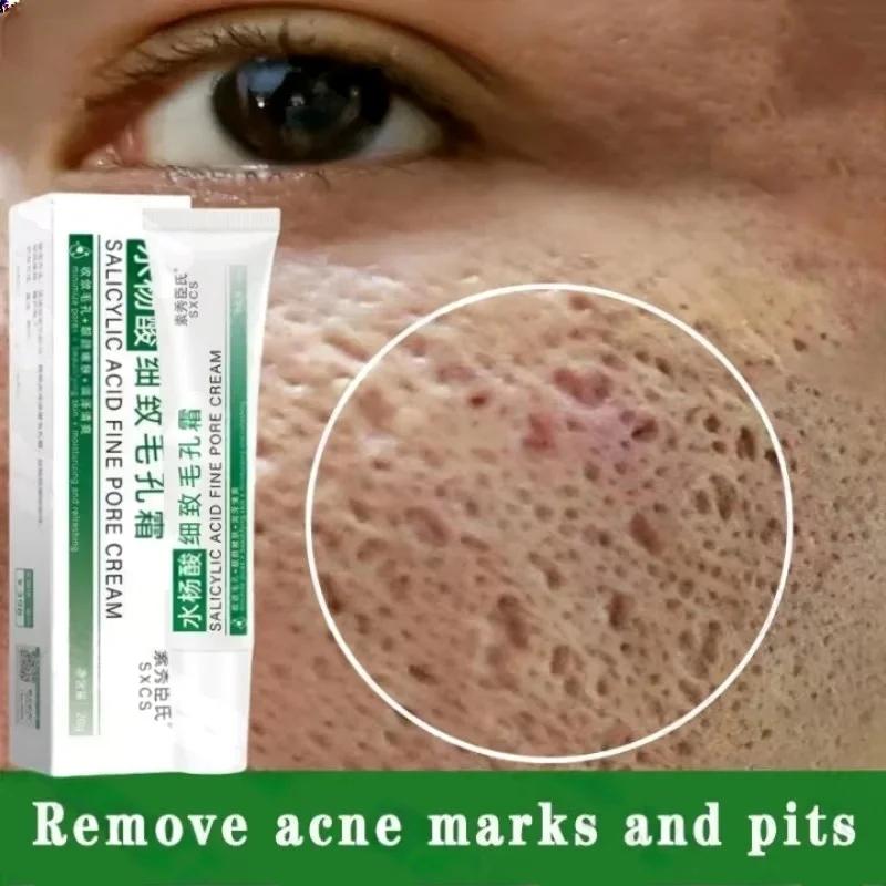 Salicylic Acid Pore Clearing C - Azelaic Acid Cream reseña y precio