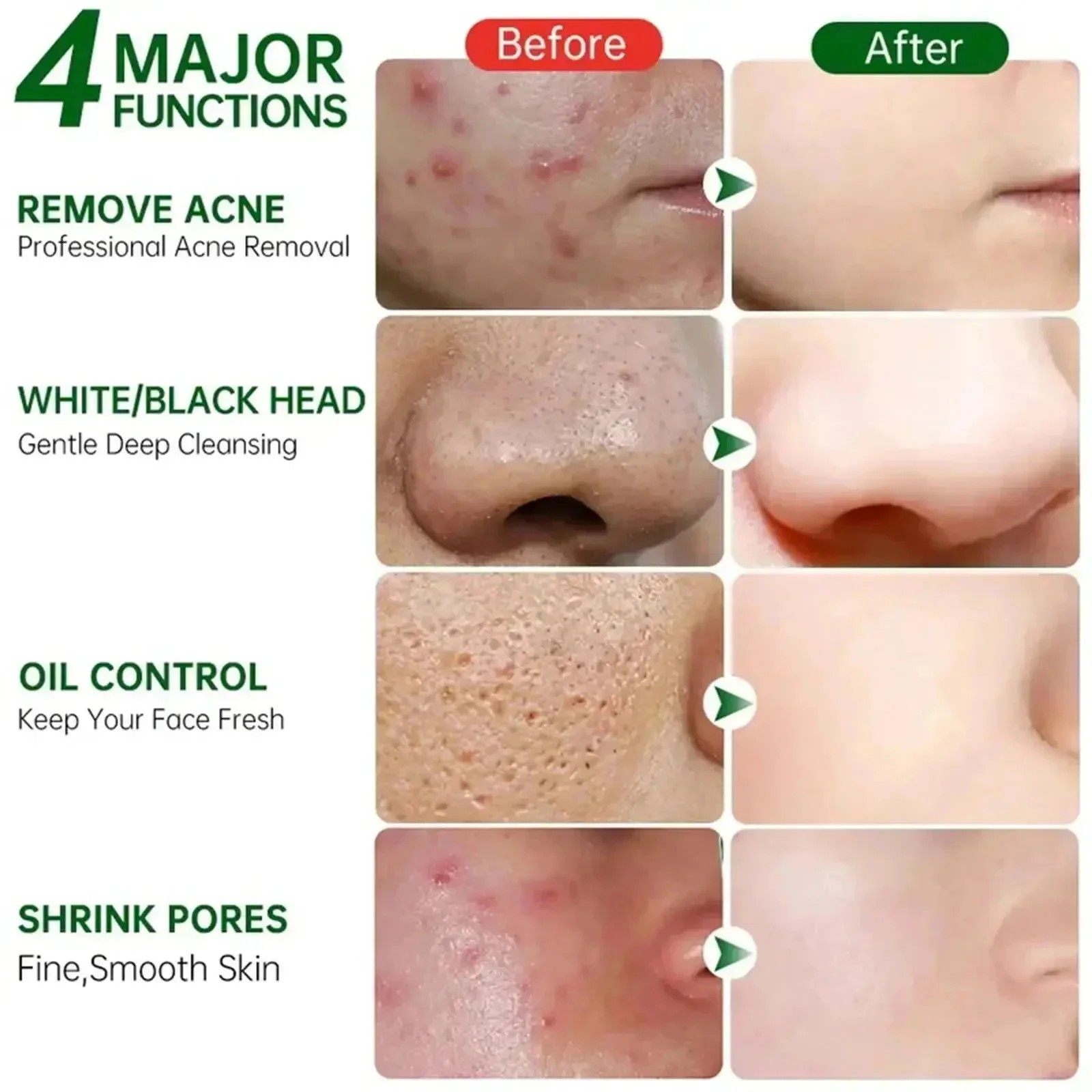 Salicylic Acid Pore Clearing C - Azelaic Acid Cream reseña y precio
