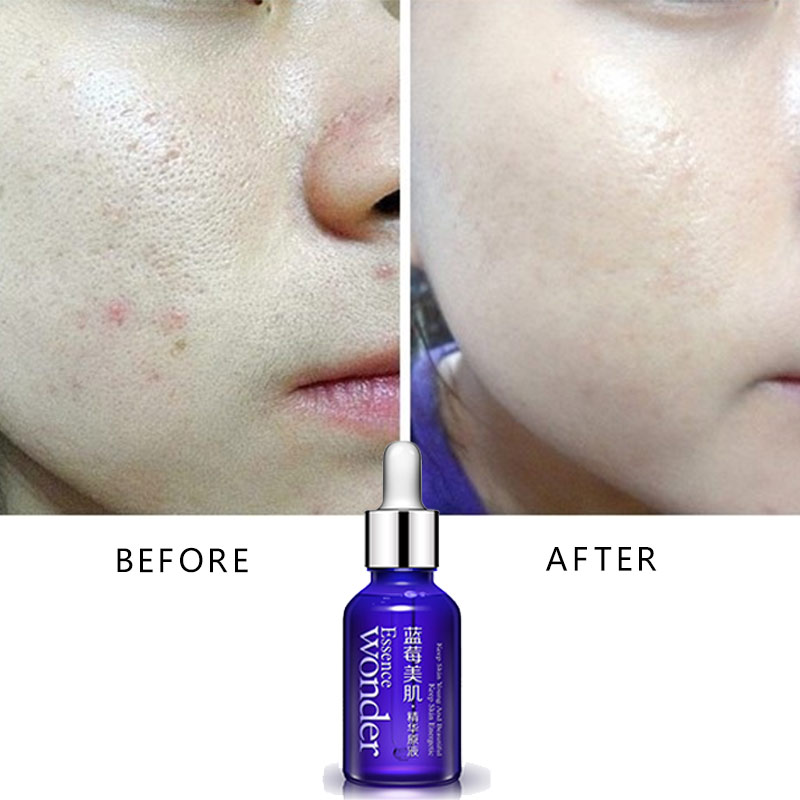 BIOAQUA Blueberry Face Lifting - Skincare Bioaqua reseña y precio