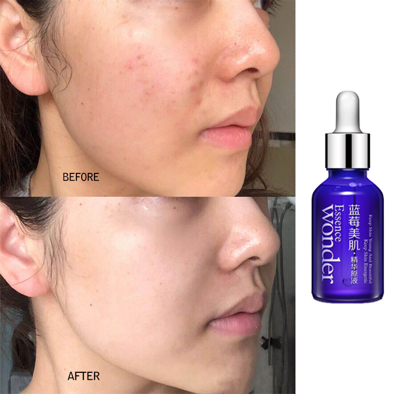 BIOAQUA Blueberry Face Lifting - Skincare Bioaqua reseña y precio