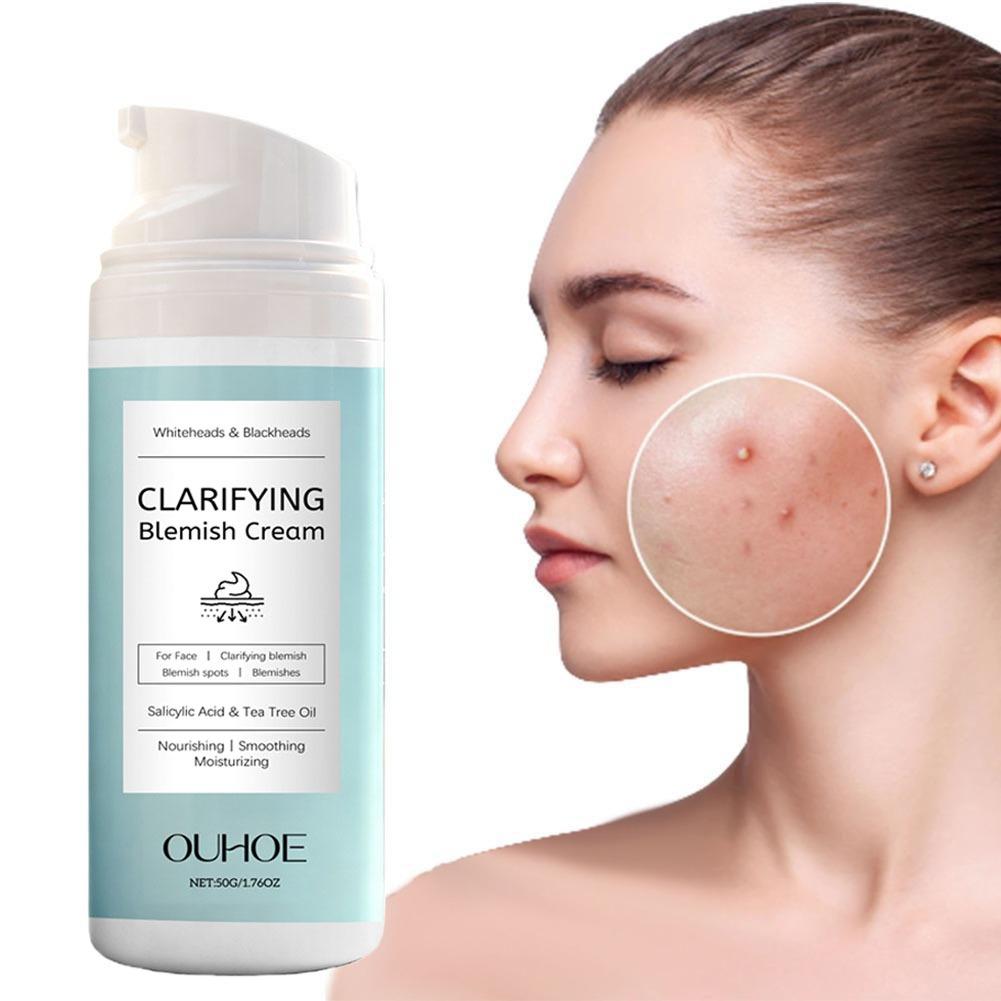 Salicylic Acid Facial Cream fo - Azelaic Acid Cream reseña y precio