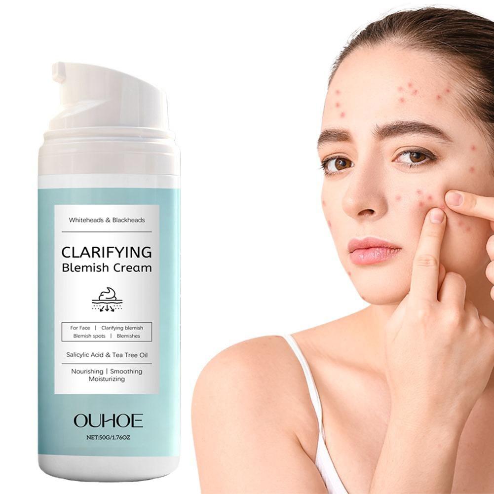 Salicylic Acid Facial Cream fo - Azelaic Acid Cream reseña y precio
