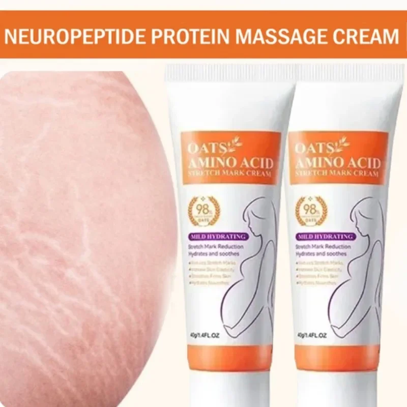 Stretch Marks Permanent Remova - Skincare Oat reseña y precio