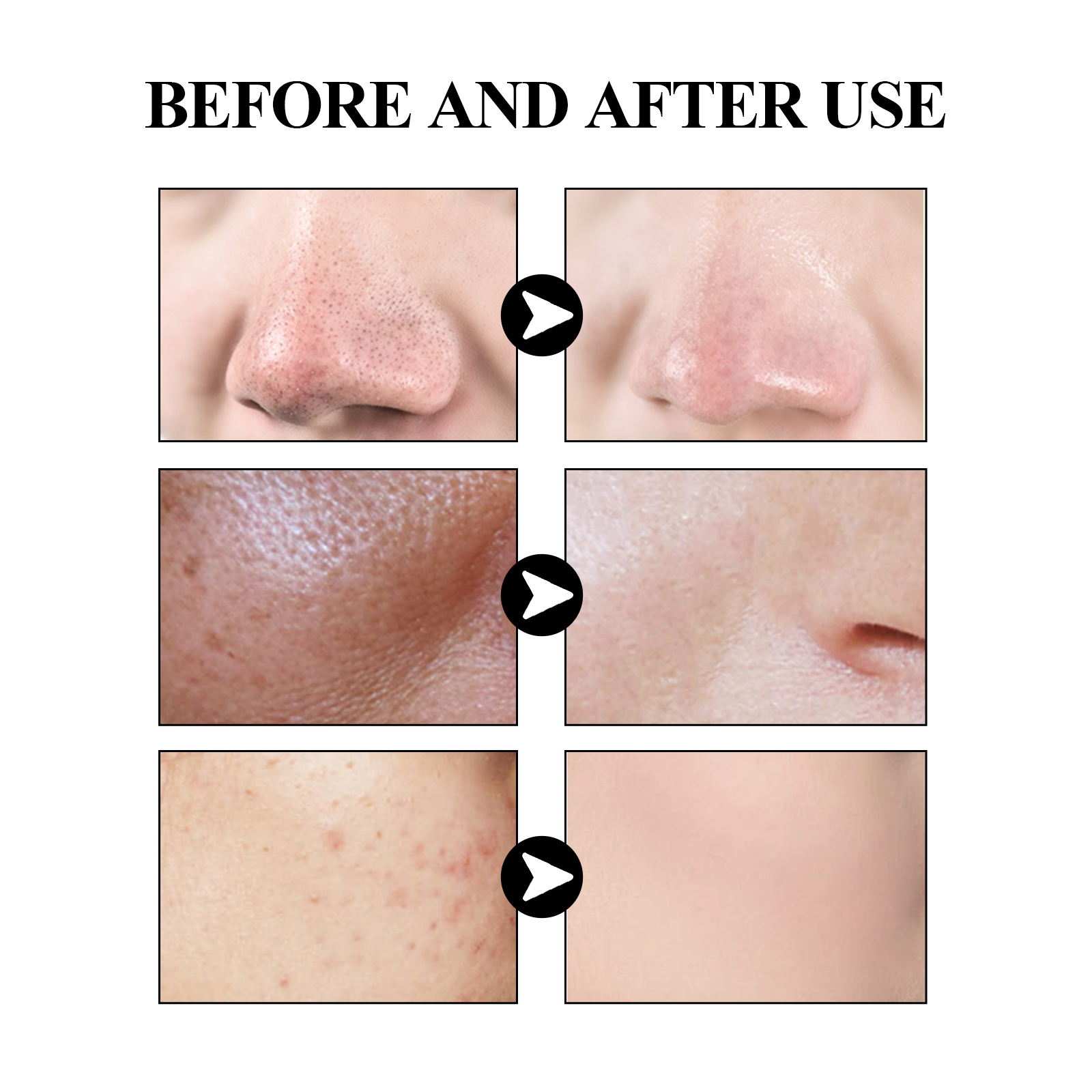 40g Activated carbon facial ma - Mud Mask Kaolin reseña y precio