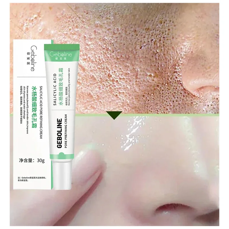 Salicylic Acid Pore Shrinking  - Azelaic Acid Cream reseña y precio