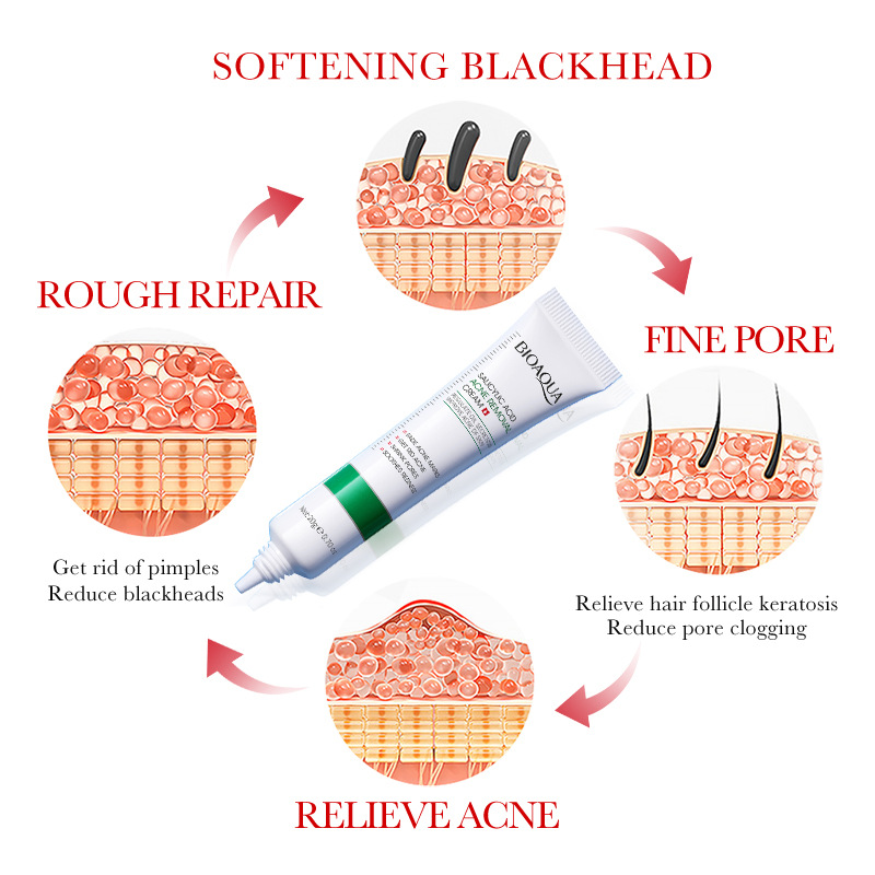 Salicylic Acid Shrink Pore Cre - Azelaic Acid Cream reseña y precio