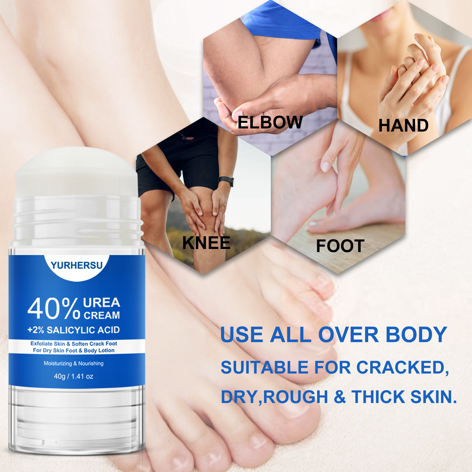 40% Urea Foot Cream Stick - Mo - Azelaic Acid Cream reseña y precio